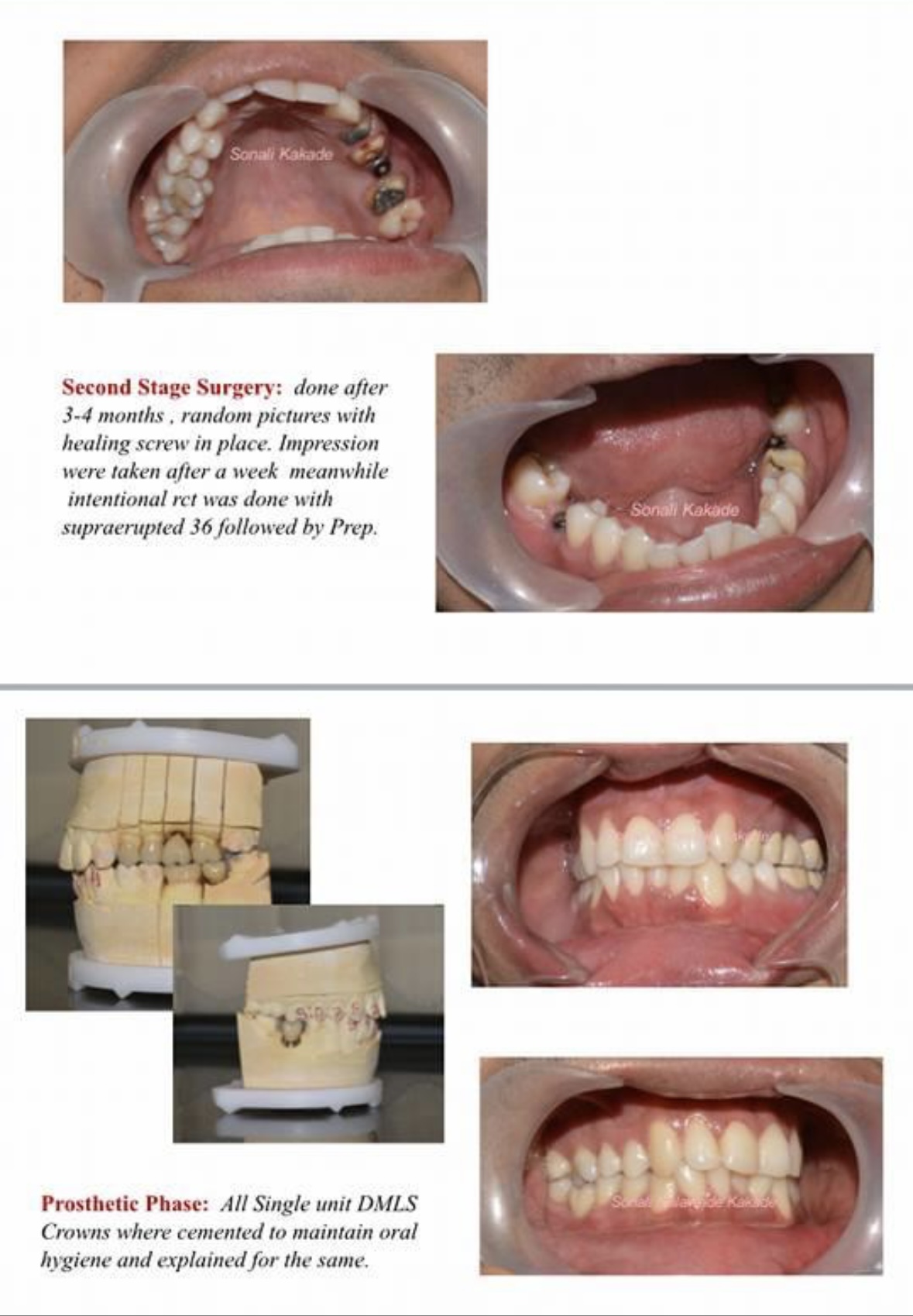 Dental Image 2